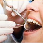 give dental encino cleaning promo
