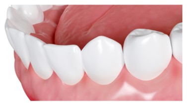 Give Dental - Healthy Gums Image