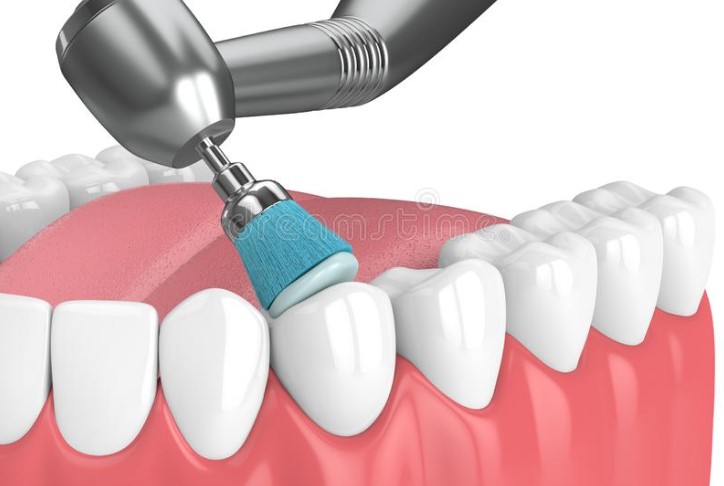 Give Dental - Tooth Polishing Image