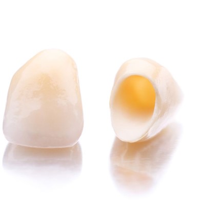 Give Dental - Ceramic Crowns image